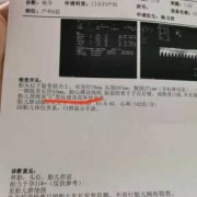 胎儿颈部可见u型压迹（胎儿颈部可见u型压迹及脐血流信号）