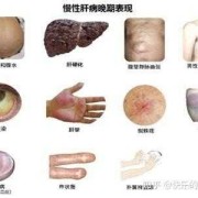 胎儿肝大（胎儿肝大是怎么回事）