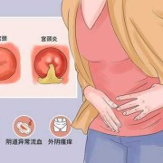 怀孕期间宫颈息肉会导致出血吗,孕期宫颈息肉出血症状有哪些