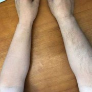 怀孕期间可以拔腿毛吗（女生说拔腿毛什么意思）