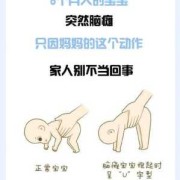 脑瘫儿在孕期的表现（脑瘫儿在孕期的表现有哪些）