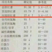 孕期胆红素高（孕期胆红素高是怎么回事有什么危害）