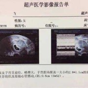 鉴定胎儿性别（鉴定胎儿性别）