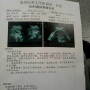 孕33周胎儿偏小三周怎么办,胎儿发育迟缓偏小几周后面又正常了