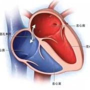 胎儿卵圆孔正常值（怀孕6个月卵圆孔0.55cm能自愈吗）