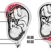 胎盘前壁和后壁胎儿图（胎盘前壁和后壁胎儿图片对比）