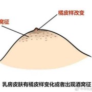 孕期乳头痒怎么缓解（怀孕期间乳头痒怎么回事）