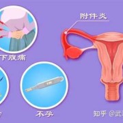 附件炎可以怀孕吗,孕期附件炎疼痛怎么办