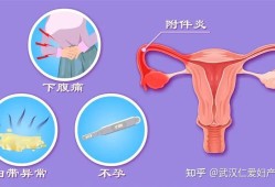 附件炎可以怀孕吗,孕期附件炎疼痛怎么办