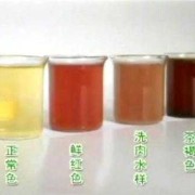 孕期尿液发红（孕期尿液发红褐色怎么回事）