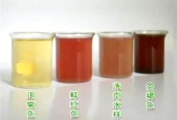 孕期尿液发红（孕期尿液发红褐色怎么回事）