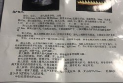 胎儿小脑欠饱满严重吗（胎儿小脑欠饱满严重吗怎么治疗）
