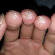 孕期手发麻（孕期手发麻怎么回事）
