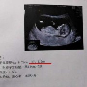 20胎儿心跳多少正常（胎儿心率150正常吗？怀孕五个月多了，可以检查畸形问题了吗）