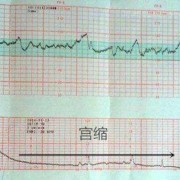 孕10周胎儿会动了吗,如何让胎儿动起来 胎心监测