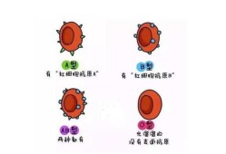 胎儿溶血症（胎儿溶血症是什么意思）