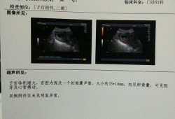 胎儿胎心170正常吗（12周胎心170正常吗）