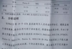 孕期胎儿亲子鉴定（孕期胎儿亲子鉴定结果和孩子出生一样吗?）