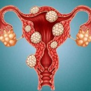 怀孕6个半月了检查子宫肌瘤变性了、会不会有什么危险,孕期子宫肌瘤变性很疼怎么办