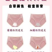孕期分泌物发黄无异味（孕期分泌物发黄无异味不痒）
