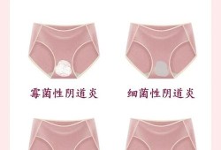 孕期分泌物发黄无异味（孕期分泌物发黄无异味不痒）