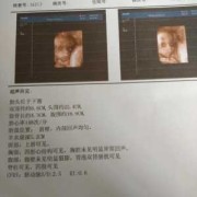 两周的胎儿（两周的宝宝视力有多远）