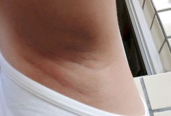 怀孕腋下变黑是怎么回事,怀男宝的9个症状,准到爆