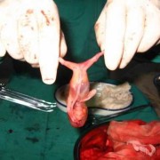 胎儿什么时候有脐带（宝宝脐带什么时候脱落呢？一般情况下脐带什么时候脱落呢）