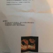 胎停原因是什么,胎儿胎停的原因有哪些