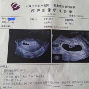 孕早期出血，可以做阴超吗,孕期可以做阴超吗有没有危险