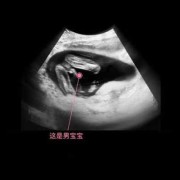 怀孕17周胎儿发育情况是怎么样的,胎儿十七周一般是多大