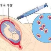 羊水穿刺会影响胎儿吗（孕妇抽羊水检查对胎儿有危害吗）