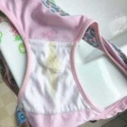 孕妇阴道炎对胎儿有影响吗（孕妇尿完尿一擦黄绿色分泌物）