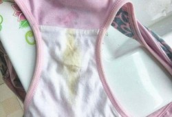孕妇阴道炎对胎儿有影响吗（孕妇尿完尿一擦黄绿色分泌物）