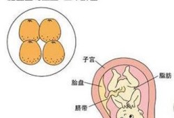 孕31周胎儿发育情况（孕31周胎儿发育情况图）
