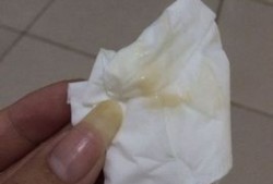 怀孕期间褐色分泌物（怀孕期间褐色分泌物正常吗）