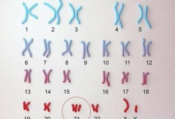 孕期染色体检查是什么（胎儿染色体检查什么）