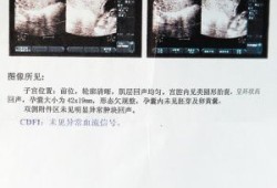 怀孕五个月怎么能死胎？孕妇怎样预防死胎呢,人为死胎的方法