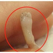 怀孕14周胎儿稳定了吗（试管怀孕14周胎儿稳定了吗）