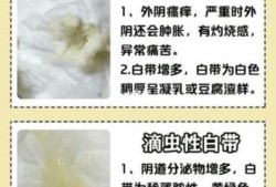 孕期白带多正常吗（怀孕会让白带增多吗？孕妇白带增多正常吗？有什么方法可以缓解）