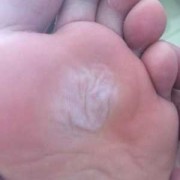 孕期脚底出汗（怀孕后为什么总出汗）