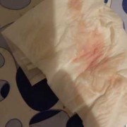 孕期见红了肚子不痛怎么办（孕妇见红了肚子不痛怎么办但是腰酸得不得了）