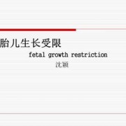 ppt受限禁止播放怎么打开,胎儿生长受限ppt课件免费