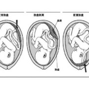 胎儿在前壁好还是后壁好（怀孕胎儿位于在前壁和后壁有什么区别吗）