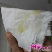 孕期白带黄浓（白带脓黄该怎么治疗）