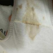 备孕期间白带发黄（孕前什么时候做白带检查最好呢）