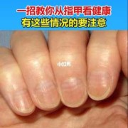 孕期指甲长得快看男女（关于指甲的科普）