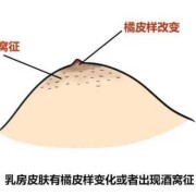 孕期乳房分泌乳（孕期乳房分泌乳液正常吗）