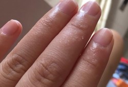 孕期手上长小水泡（孕晚期手上脚上长了许多小水泡咋回事啊）