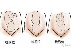 32周胎儿头位图（32周胎儿头位图片）